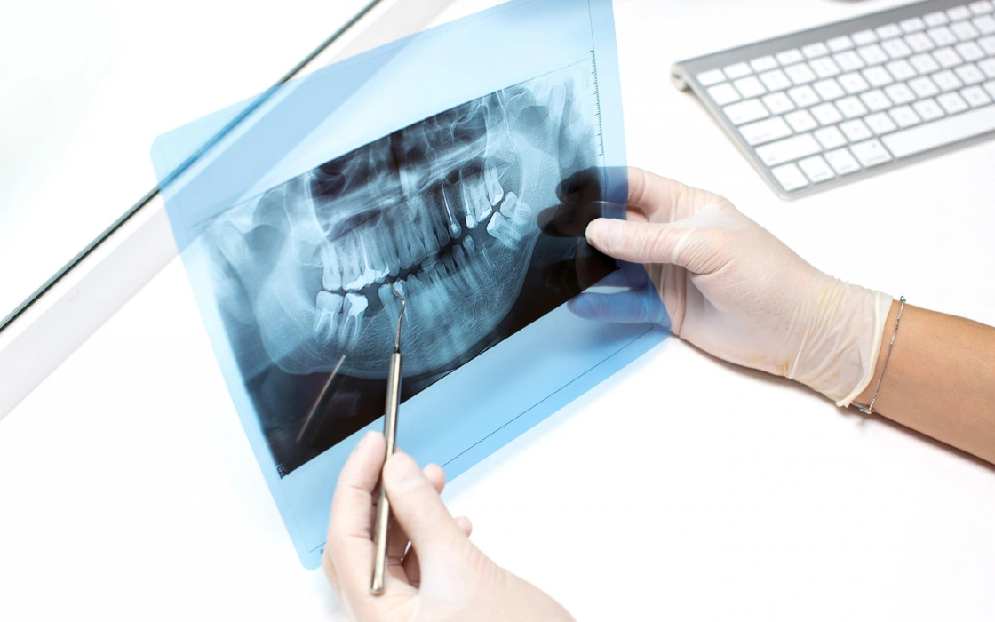 Regeneración periodontal y ósea