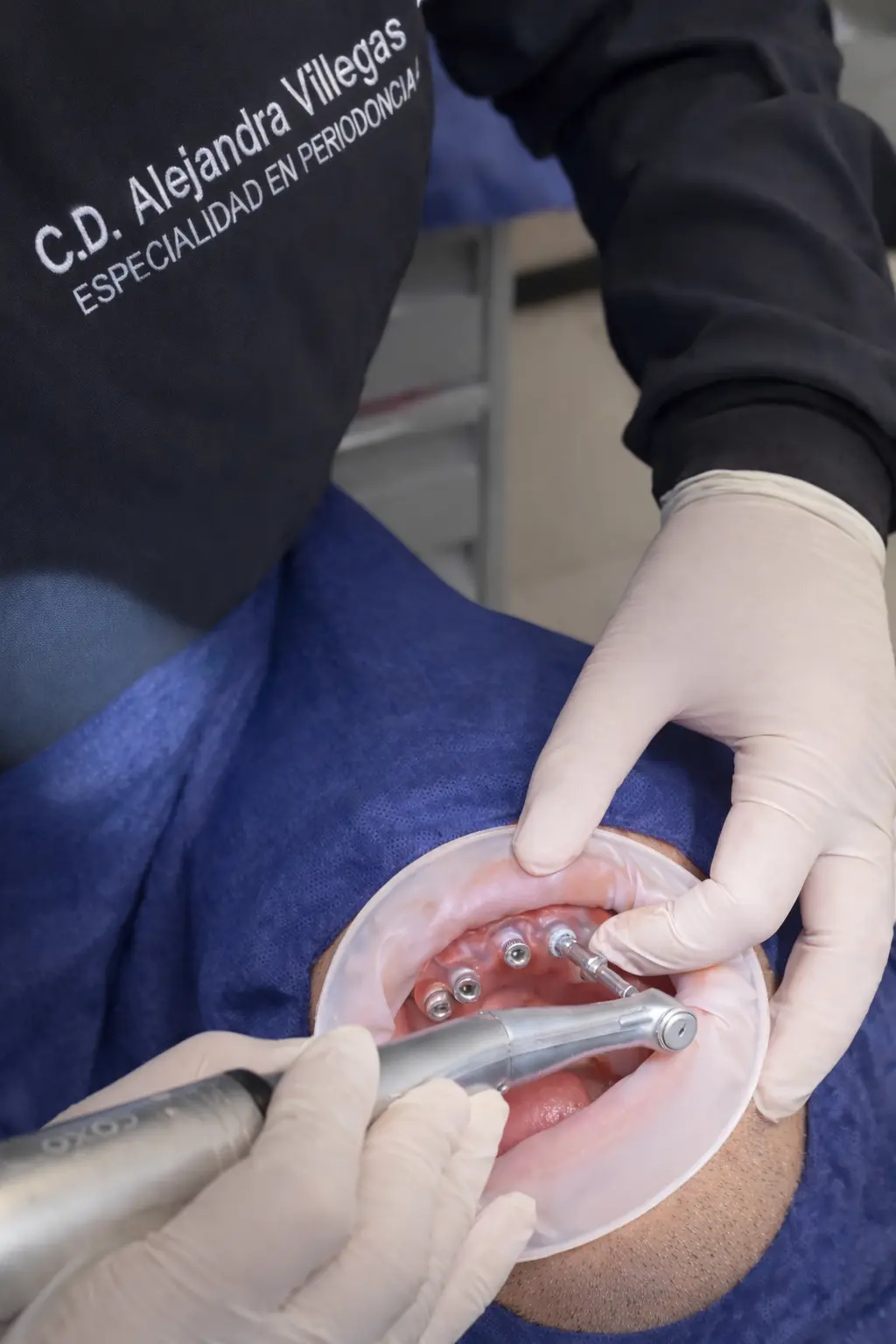 Consulta especializada en periodoncia